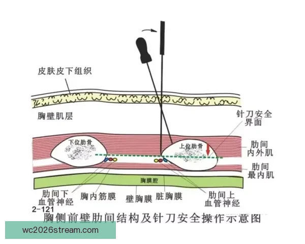 里夫斯腹斜肌二级损伤专家解析詹皇季后赛核心策略